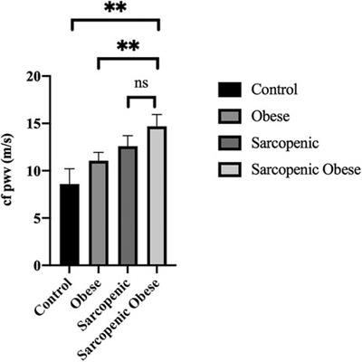 Sarcopenia, sarcopenic obesity, and arterial stiffness among older adults